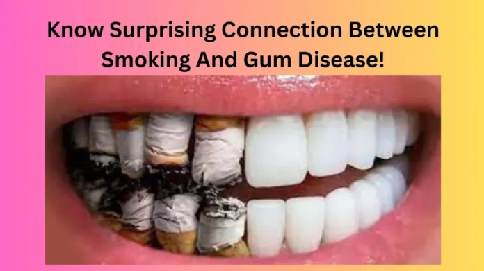 Know Surprising Connection Between Smoking And Gum Disease!