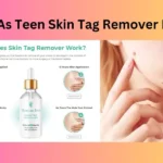 Clean As Teen Skin Tag Remover Review