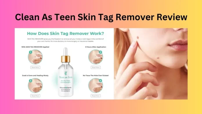 Clean As Teen Skin Tag Remover Review