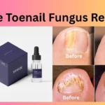 Stride Toenail Fungus Reviews